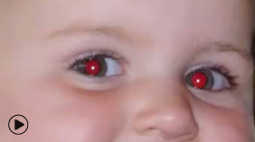 Kırmızı Göz Aracı (Red Eye Tool)